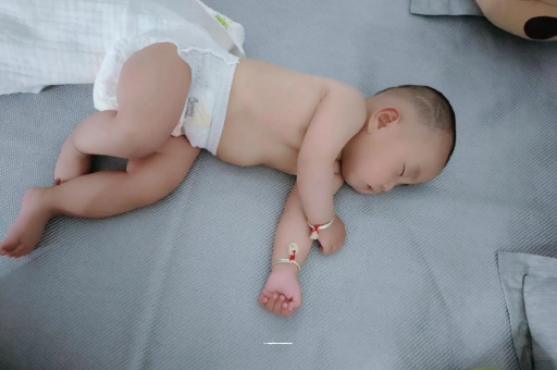 重庆宝宝褶皱处擦粉还是油